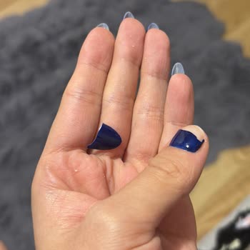 Eylül Öztürk Nail Spa Protez Tırnak Ve Kalıcı Oje İşleminde Kısa Sürede Yaşanan Sorunlar