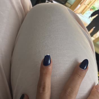 Eylül Öztürk Nail Spa Protez Tırnak Ve Kalıcı Oje İşleminde Kısa Sürede Yaşanan Sorunlar