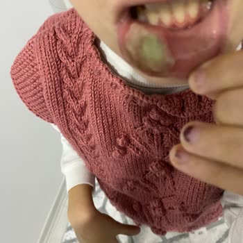 Çocuğuma Uygulanan Yanlış Tedavi Ve Doktorun Saygısız Tavrı Endişemizi Artırdı