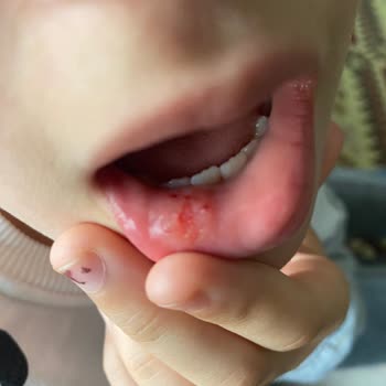 Çocuğuma Uygulanan Yanlış Tedavi Ve Doktorun Saygısız Tavrı Endişemizi Artırdı