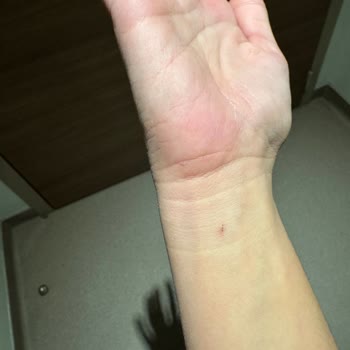 Medical Park Hastanesi Hasta Güvenliği Ve Bakımda Ciddi Aksaklıklar!