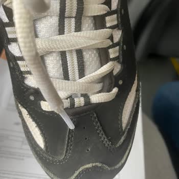 Skechers 1 Haftada Açılan Ayakkabıya Kullanıcı Hatası Denilmesi Mağdur Etti!