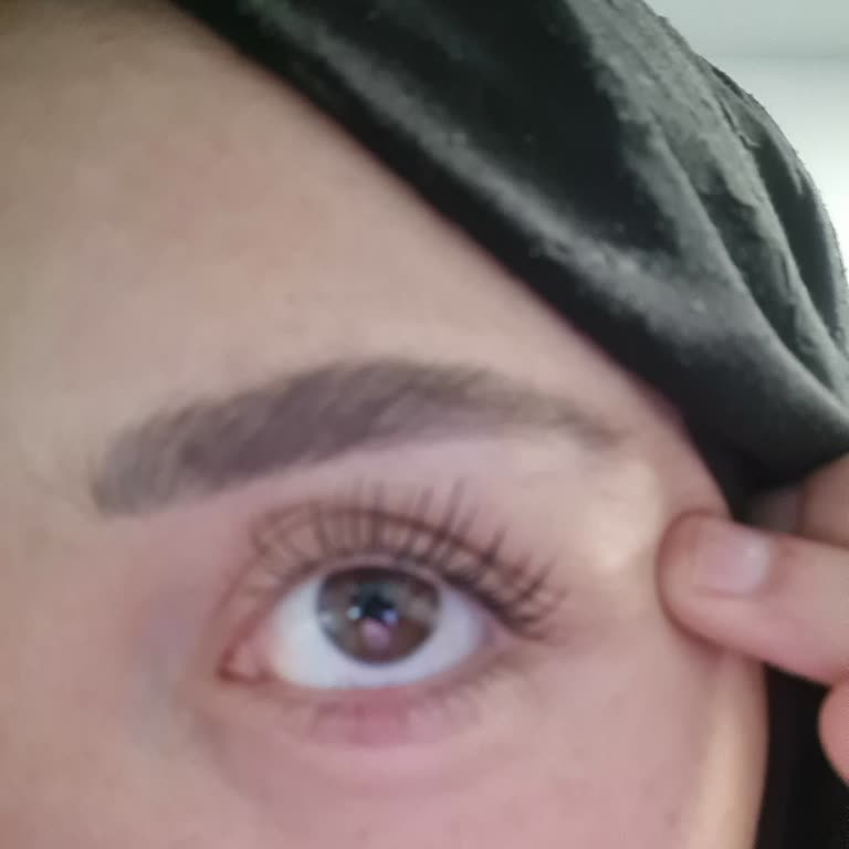 Maskara Kullanımı Sonrası Gözde Hassasiyet Ve Arpacık Problemi Yaşadım