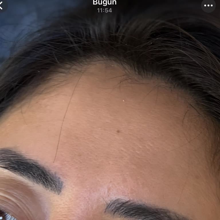 Muse Brows & Lashes Aldatıcı Paylaşımlar Ve Yanlış Microblading Sonucu Mağduriyeti