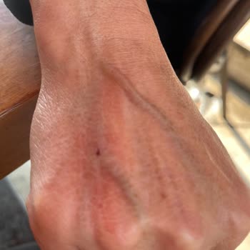 Mazhar Osman Ruh Ve Sinir Hastalıkları Kan Alma Ünitesinde Dikkatsiz Ve İlgisiz Personel