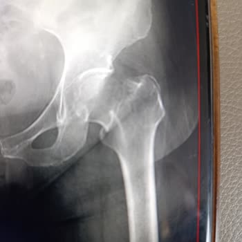 Medicana Sağlık Grubu Acil Serviste Bariz Kalça Kırığı Gözden Kaçtı Annem 15 Gün Acı Çekti