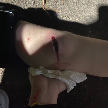 Çocuk Parkında Tehlikeli Çeşme: Acil Önlem Alınmalı