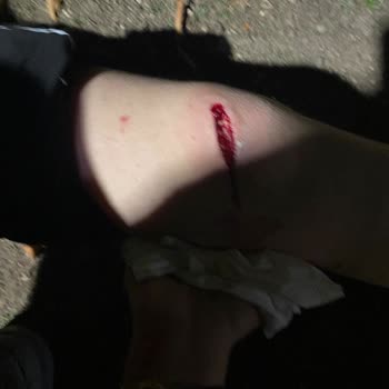 Çocuk Parkında Tehlikeli Çeşme: Acil Önlem Alınmalı