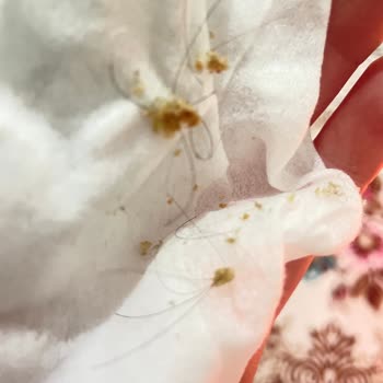 Dalin Bebek Şampuanı Oğlumda Egzamaya Sebep Oldu, Acil İnceleme Talebi