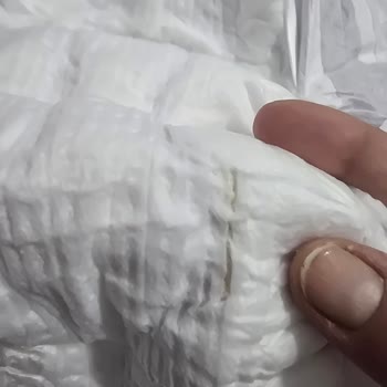 Molfix Yeni Doğan Bebek Bezinde Sarı Leke Hijyen Endişesi Yarattı