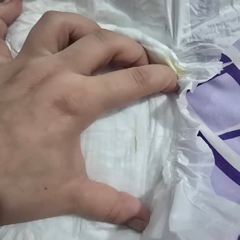 Molfix Yeni Doğan Bebek Bezinde Sarı Leke Hijyen Endişesi Yarattı