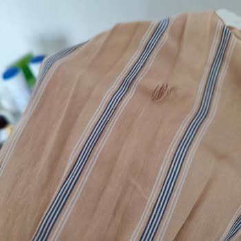 Aldığım Ürün Kısa Sürede Deforme Oldu, Kullanıcı Hatası Denildi