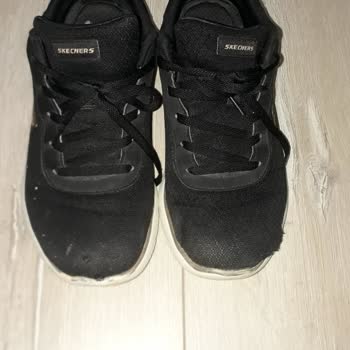 Kısa Sürede Deforme Olan Skechers Ayakkabıya Karşı İlgisiz Müşteri Hizmeti Ve Mağaza Yaklaşımı
