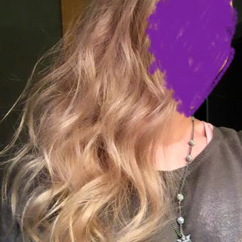 Esteworld Ataşehir'de Sonuçsuz Tedavi Ve Yanıltıcı Bilgilendirme Mağduriyeti