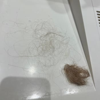 Esteworld Ataşehir'de Sonuçsuz Tedavi Ve Yanıltıcı Bilgilendirme Mağduriyeti