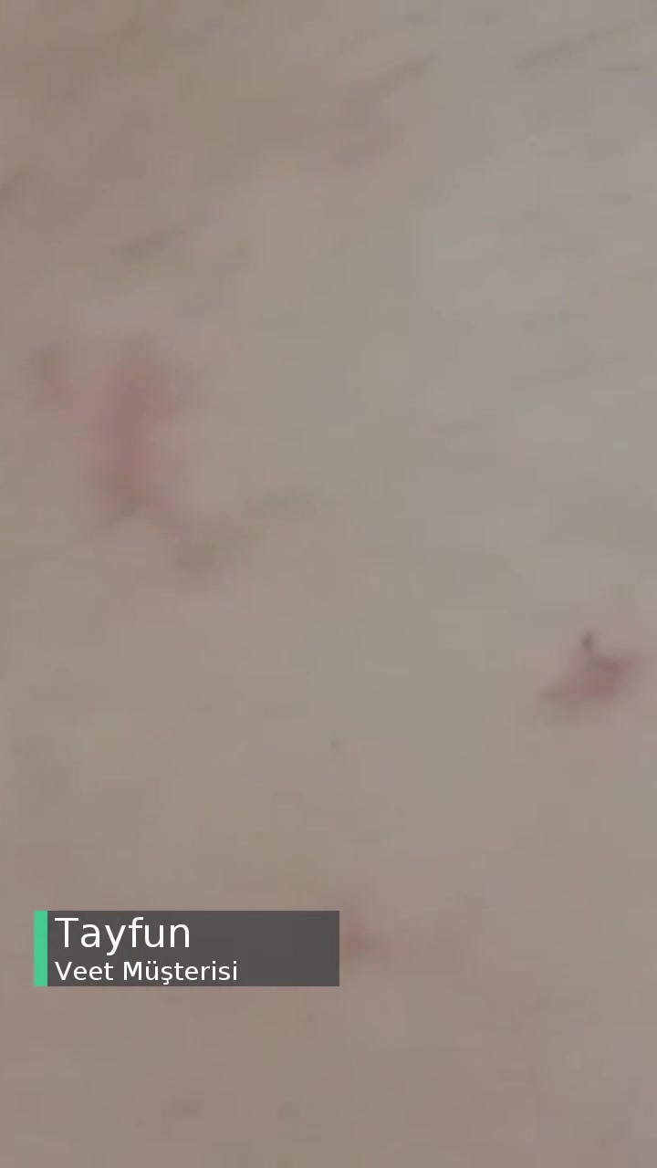 Veet Cildimi Tahriş Etti videonun kapak resmi
