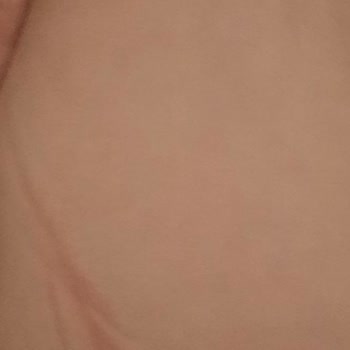 Baby Mall Klozet Adaptörü Çocuğuma Zarar Verdi, İade Süreci Mağdur Ediyor