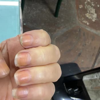 Pastel Kozmetik Ojeyi Çıkardığımda Tırnaklarımın Sarardığını Fark Ettim