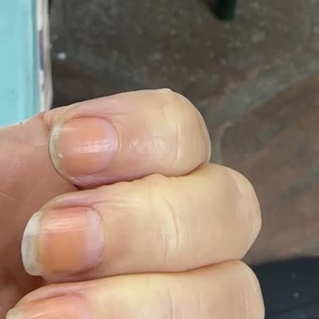 Pastel Kozmetik Ojeyi Çıkardığımda Tırnaklarımın Sarardığını Fark Ettim