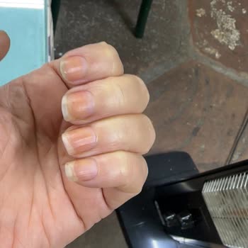 Pastel Kozmetik Ojeyi Çıkardığımda Tırnaklarımın Sarardığını Fark Ettim