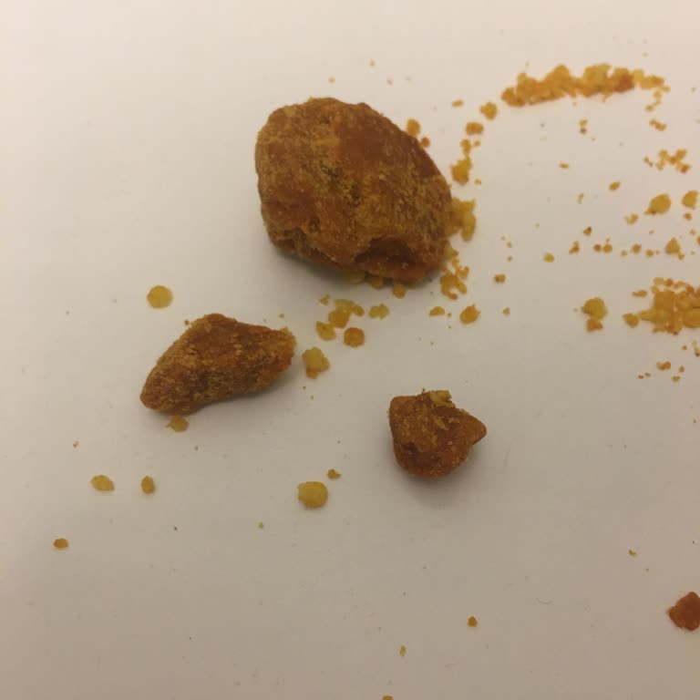 Eti Crax İçinde Çıkan Sert Topaklar Oğlumun Sağlığını Riske Attı