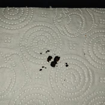 A101'den Alınan Cips Paketinde Yabancı Maddeyle Karşılaştım Hijyen Endişesi Yaşıyorum