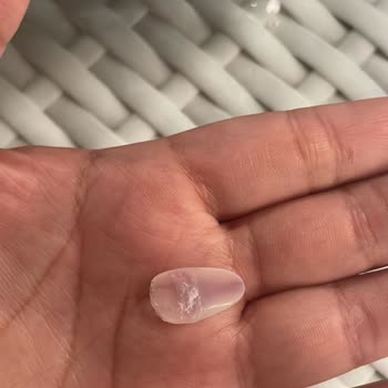 Protez Tırnak Uygulaması Sonrası Mağduriyet Ve Ek Ücret Talebi