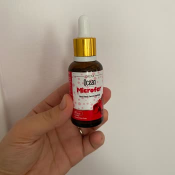 Bebek Demir Takviyesinde Yabancı Madde Şoku: Güvenim Sarsıldı