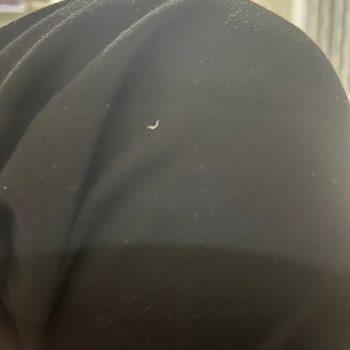 Sensodyne Diş Macunu Sonrası Ağızda Yaralar Ve Soyulma Yaşadım