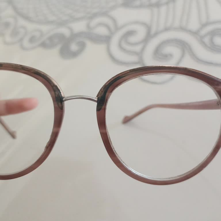 Osse Yüksek Fiyatlı Gözlükte Kısa Sürede Yaşanan Sorun ve Çözüm Talebi