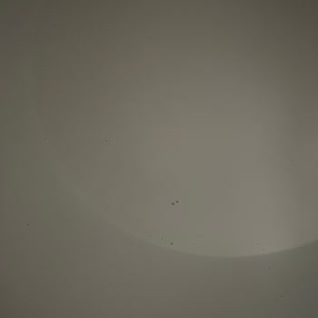 Dayanıksız Banyo Seti Ve Yetersiz Müşteri Hizmeti Nedeniyle İade Talebi