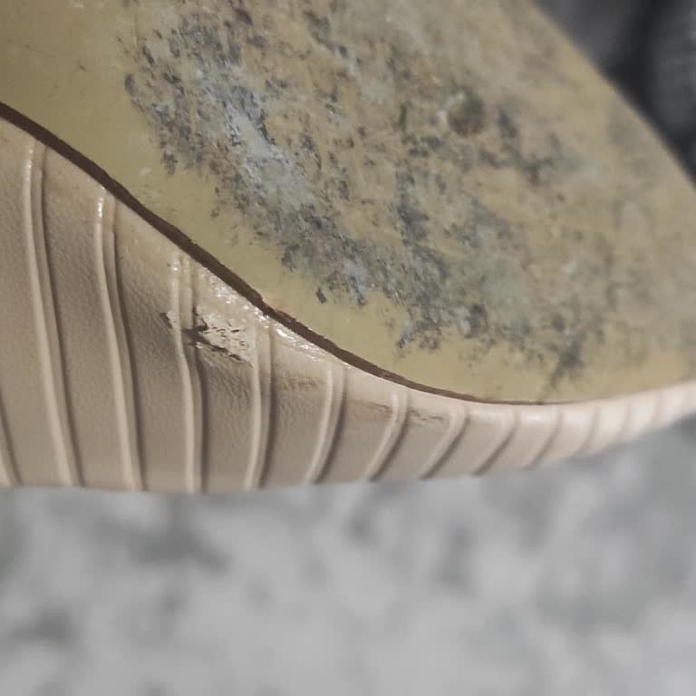 Tamer Tanca Kısa Sürede Açılan Ayakkabı Ve Garanti Süresi Nedeniyle Destek Sağlanmaması