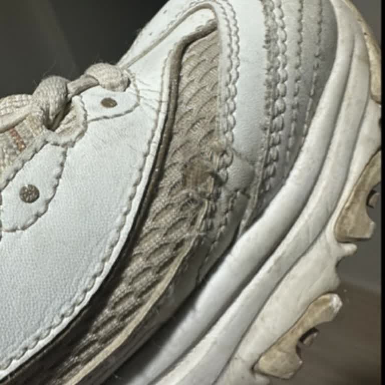 Skechers Ayakkabıda Kısa Sürede Deformasyon Ve Olumsuz Garanti Yanıtı