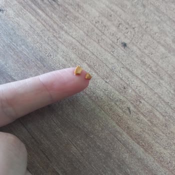 Müsli İçindeki Sert Kabuklar Diş Dolgumu Düşürdü