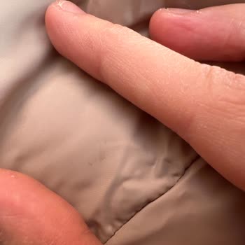 Yırtık Paket Ve Kan Lekeli Çocuk Montu Teslimatı, Destek Alınamaması