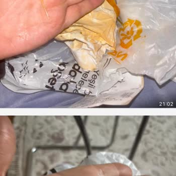Siparişimde Tavuk Tüyü Çıktı Hijyen Ve Güven Sorunu Yaşadım
