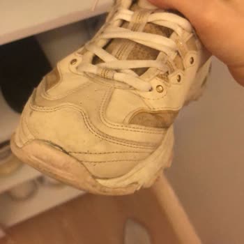 Kısa Sürede Açılan Ayakkabı İçin Çözüm Bekliyorum