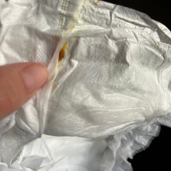 Bebek Bezinde Tanımlanamayan Cisim Ve Değişim Talebi