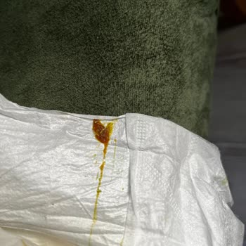 Bebek Bezinde Tanımlanamayan Cisim Ve Değişim Talebi