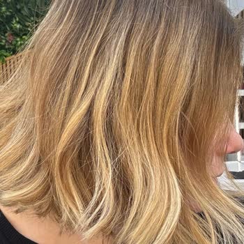 Saç Boyama Sonrası Ağır Zarar Ve Yüksek Ücret Mağduriyeti