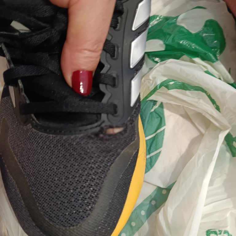 Kullanıcı Hatası Gerekçesiyle Ret Edilen Ayakkabı Şikayeti