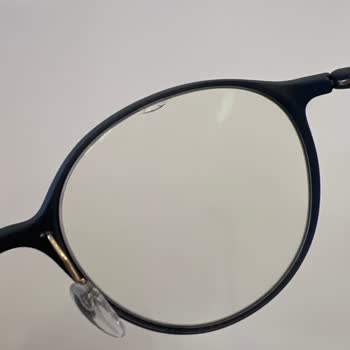 Yüksek Bedelli Gözlükte Garanti Eksikliği Ve Cam Çatlağı Mağduriyeti
