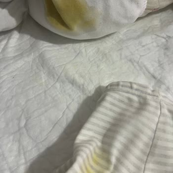 Sleepy Bebek Bezi Sürekli Sızdırıyor, Acil Çözüm Bekliyorum