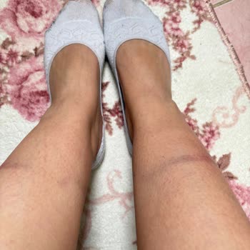 Sağlığa Zararlı Ve Ayıplı Ürün Nedeniyle İade Talebi