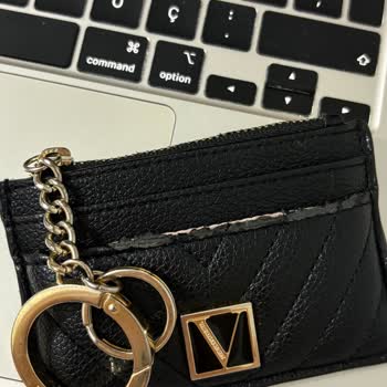 Victoria’s Secret Kartlıkta Erken Soyulma Ve Kalite Sorunu