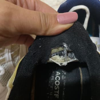 Lacoste Spor Ayakkabıda Kısa Sürede Deformasyon Ve Rahatsızlık