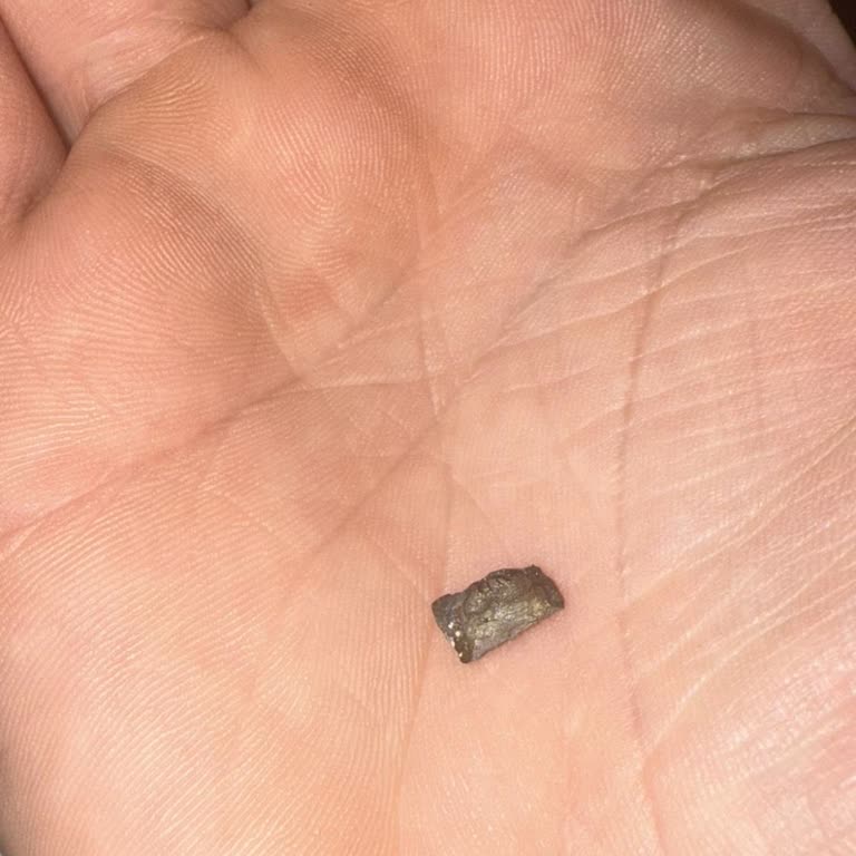 Cipsin İçinden Taş Çıktı, Dişim Kırıldı: Sağlığım Tehlikeye Girdi