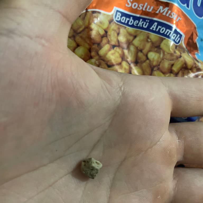 Amigo Soslu Mısırdan Taş Çıktı, Dişim Kırıldı: Güvenim Sarsıldı
