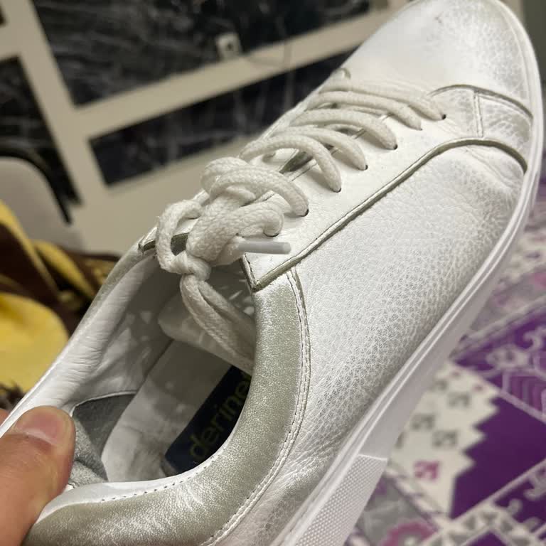 Kısa Sürede Deforme Olan Ayakkabıda Hayal Kırıklığı