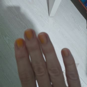 Pastel Oje Tırnaklarımı Sararttı Sağlığım Tehlikede